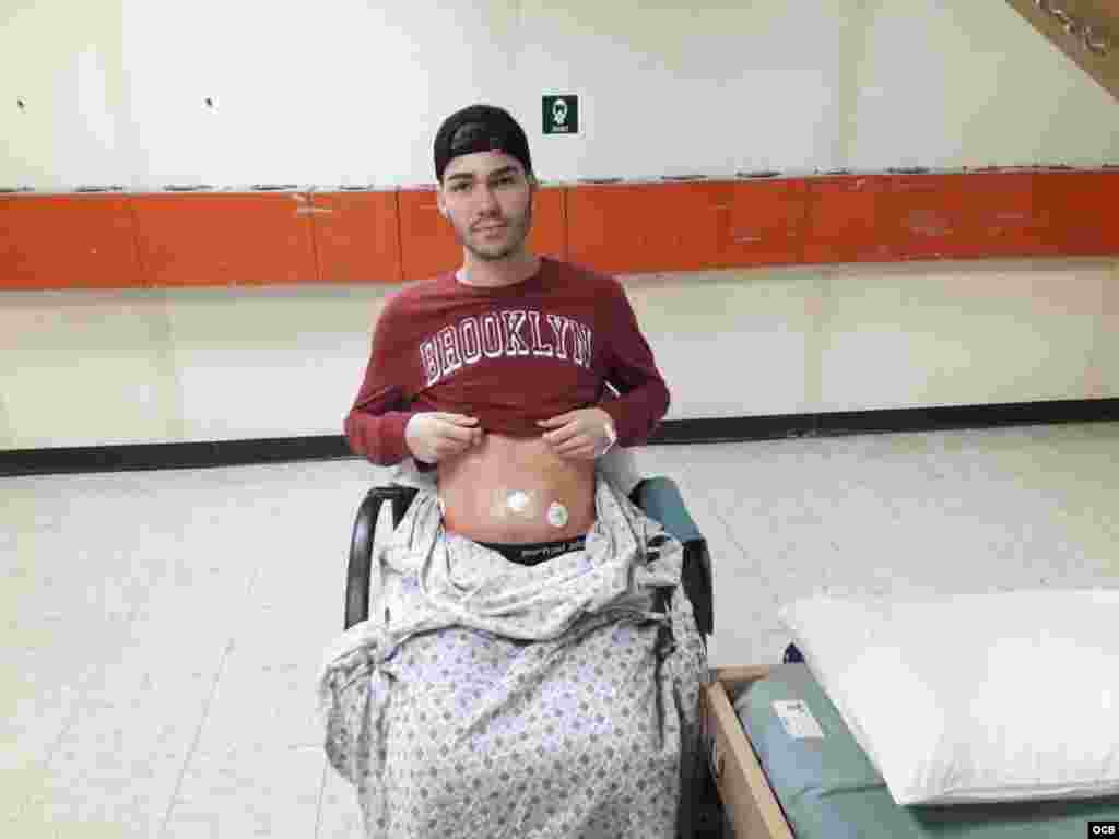 Erick Reyes &quot;Cuco&quot; tras ser operado en el Comfort de una hernia hernia umbilical.