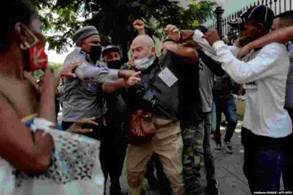 El fot&#243;grafo de AP, el espa&#241;ol Ram&#243;n Espinosa, aparece con heridas en la cara mientras cubr&#237;a una manifestaci&#243;n contra el presidente cubano Miguel D&#237;az-Canel en La Habana, el 11 de julio de 2021