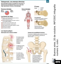 INFOGRAFIA : OSTEOPOROSIS , UNA AMENAZA SILENCIOSA